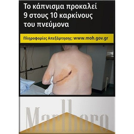 A warning-style poster with Greek text at the top, a central photo of a person seen from behind with a scar on their back, and a lower panel with a gold-and-white striped design. No retail product is clearly being sold here; this is best classified as Other rather than Lifestyle because the image functions as informational/health messaging artwork.